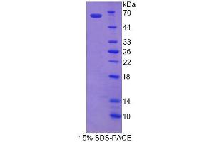 Image no. 1 for ATP-Binding Cassette, Sub-Family D (Ald), Member 1 (ABCD1) (AA 102-386) protein (ABIN6239359)