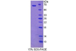 Image no. 1 for ATP-Binding Cassette, Sub-Family D (Ald), Member 1 (ABCD1) (AA 102-386) protein (ABIN6239359) (ABCD1 Protein (AA 102-386))