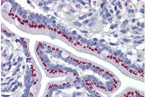 Human Small Intestine: Formalin-Fixed, Paraffin-Embedded (FFPE)