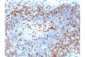 Formalin-fixed, paraffin-embedded human Lymph Node stained with ZAP70 Mouse Monoclonal Antibody (ZAP70/2046). (ZAP70 anticorps  (AA 247-382))