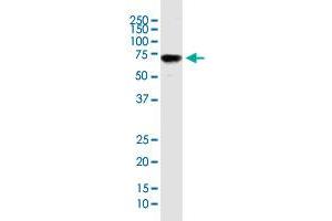 ENG monoclonal antibody (M26), clone 1E5.
