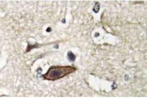 Immunohistochemistry (IHC) analyzes of Tsg 101 antibody in paraffin-embedded human brain tissue. (TSG101 anticorps)