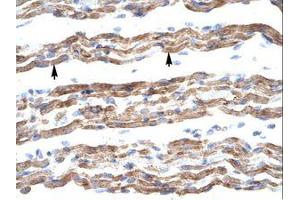 Image no. 1 for anti-Polyglutamine Binding Protein 1 (PQBP1) (AA 58-107) antibody (ABIN202137)