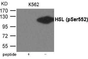 Western blot analysis of extracts from K562 cells using HSL (Phospho-Ser552) Antibody. (LIPE anticorps  (pSer552))