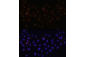 anti-Ha-Ry/enhancer-of-Split Related with YRPW Motif 1 (HEY1) (AA 50-150) antibody