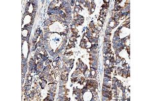 IHC analysis of MUT using anti-MUT antibody (ABIN4886676). (MUT anticorps  (N-Term))