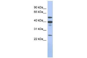 MMP13 antibody used at 1 ug/ml to detect target protein. (MMP13 anticorps)