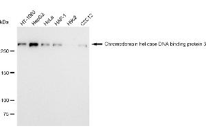 Western blotting analysis using Chromodomain helicase DNA binding protein 3 antibody (ABIN7798069). (Recombinant CHD3 anticorps)
