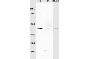 L1 rat liver lysates L2 rat kidney lysates probed with Rabbit Anti-ERK1 (Thr203/Tyr205) + ERK2 (Thr183/Tyr185) Polyclonal Antibody, Unconjugated (ABIN687727) at 1:200 overnight at 4 °C. (ERK1/2 anticorps  (pThr183, pTyr185))