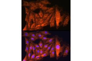 Immunofluorescence analysis of Rat H9C2 cells using CK antibody (ABIN6127628, ABIN6138647, ABIN6138648 and ABIN6224627) at dilution of 1:100. (CKAP5 anticorps  (AA 1763-2032))