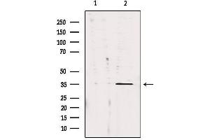Western blot analysis of extracts from 293, using CA13 Antibody. (CA13 anticorps  (Internal Region))