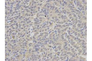 Immunohistochemistry (IHC) image for anti-Proteasome (Prosome, Macropain) 26S Subunit, ATPase, 2 (PSMC2) antibody (ABIN1874379) (PSMC2 anticorps)