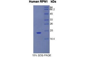SDS-PAGE (SDS) image for Ribophorin 1 (RPN1) (AA 180-307) protein (His tag) (ABIN1981107) (RPN1 Protein (AA 180-307) (His tag))