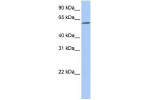 WB Suggested Anti-SLC22A14 Antibody Titration:  0. (SLC22A14 anticorps  (N-Term))