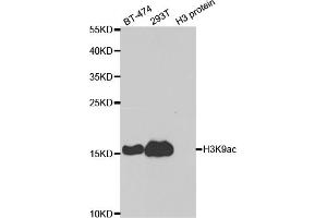 Western blot analysis of extracts of various cell lines, using Acetyl-Histone H3-K9 antibody (ABIN4903918) at 1:1000 dilution.