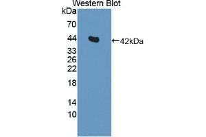 Detection of Recombinant IL11Ra, Rat using Polyclonal Antibody to Interleukin 11 Receptor Alpha (IL11Ra) (IL11RA anticorps  (AA 24-371))