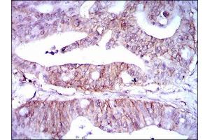 Immunohistochemistry (IHC) image for anti-Lipoprotein (Lp(a)) (AA 4330-4521) antibody (ABIN1845714) (Lp(a) anticorps  (AA 4330-4521))