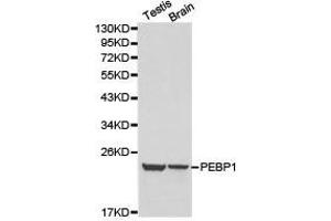 Western Blotting (WB) image for anti-Phosphatidylethanolamine Binding Protein 1 (PEBP1) antibody (ABIN1874092) (PEBP1 anticorps)