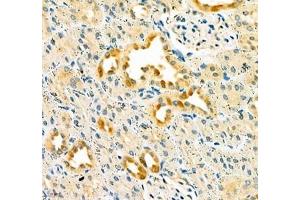 Immunohistochemistry of paraffin embedded rat kidney using Dmac2l (ABIN7073751) at dilution of 1: 650 (400x lens) (Distal Membrane Arm Assembly Complex 2 L Homeolog (DMAC2.L) anticorps)