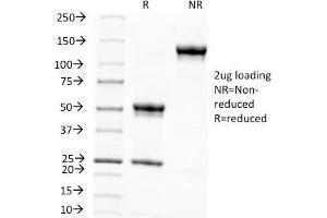 SDS-PAGE Analysis Purified Melanoma Monoclonal Antibody (KBA. (Melanoma Associated Antigen (KBA.62) anticorps)