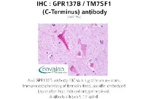 Image no. 2 for anti-G Protein-Coupled Receptor 137B (GPR137B) (C-Term) antibody (ABIN1734939) (GPR137B anticorps  (C-Term))