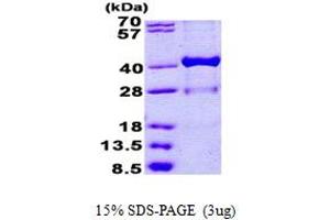 SDS-PAGE (SDS) image for Hydroxysteroid (17-Beta) Dehydrogenase 1 (HSD17B1) (AA 1-328) protein (His tag) (ABIN5852977)