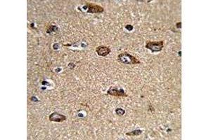 IHC analysis of FFPE human brain tissue with Rab5 antibody