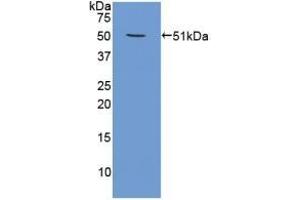 Detection of Recombinant PSMC4, Human using Polyclonal Antibody to Proteasome 26S Subunit, ATPase 4 (PSMC4)
