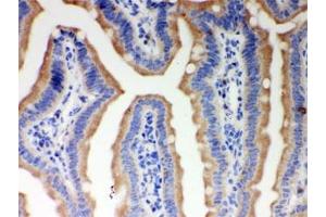 IHC testing of FFPE mouse intestine with ITPR3 antibody. (ITPR3 anticorps)