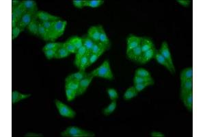 Immunofluorescence staining of HepG2 cells with ABIN7149946 at 1:166, counter-stained with DAPI.