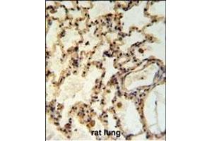 IL Antibody (Center) (ABIN653951 and ABIN2843173) IHC analysis in formalin fixed and paraffin embedded rat lung tisssue followed by peroxidase conjugation of the secondary antibody and DAB staining. (IMMP2L anticorps  (AA 81-109))