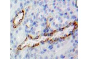 Used in DAB staining on fromalin fixed paraffin-embedded Kidney tissue (CD73 anticorps  (AA 29-550))