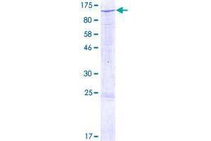 Image no. 1 for Sema Domain, Immunoglobulin Domain (Ig), Short Basic Domain, Secreted, (Semaphorin) 3G (SEMA3G) (AA 1-782) protein (GST tag) (ABIN1319468)