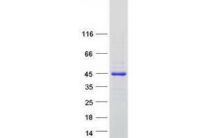 Validation with Western Blot (UBE2V1 Protein (Transcript Variant 1) (Myc-DYKDDDDK Tag))