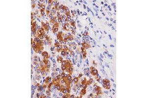 (ABIN6243770 and ABIN6577238) staining REG3G in human pancreas tissue sections by Immunohistochemistry (IHC-P - paraformaldehyde-fixed, paraffin-embedded sections). (REG3g anticorps)
