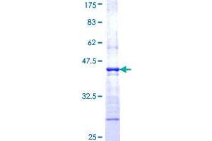 Image no. 1 for Wiskott-Aldrich Syndrome (Eczema-thrombocytopenia) (WAS) (AA 57-170) protein (GST tag) (ABIN1325154)