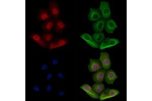 Phospho-XBP1 (Ser68) Antibody staining Hela cells(heat shock treatment) by IF/ICC. (XBP1 anticorps  (pSer68))