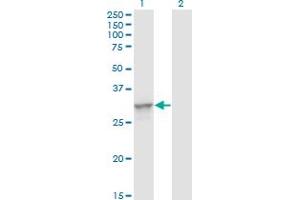 Western Blot analysis of TOLLIP expression in transfected 293T cell line by TOLLIP monoclonal antibody (M01), clone 1A5-2A3.