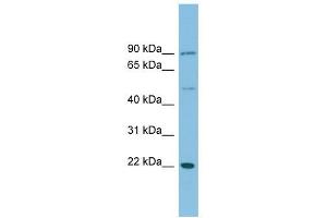 DNAJC12 antibody used at 1 ug/ml to detect target protein. (DNAJC12 anticorps)