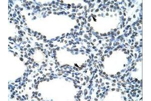 anti-Transformer 2 beta Homolog (TRA2B) (N-Term) antibody