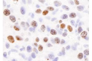 Immunohistochemistry (IHC) image for anti-H2A Histone Family, Member X (H2AFX) (C-Term) antibody (ABIN7448589)