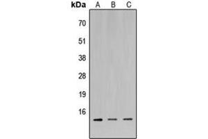 Western blot analysis of MIA1 expression in HeLa (A), Raw264. (MIA anticorps  (C-Term))
