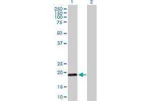 Western Blot analysis of MYL5 expression in transfected 293T cell line by MYL5 MaxPab polyclonal antibody.