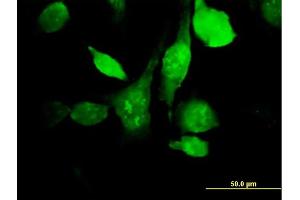 anti-Hyaluronidase-3 (HYAL3) (AA 1-417) antibody