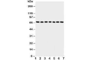 Western blot testing of NOX4 antibody and Lane 1:  rat kidney;  2: (r) heart;  3: (r) spleen;  4: human HeLa;  5: (h) 293T;  6: (h) MCF-7;  7: (h) SMMC-7721 cell lysate. (NADPH Oxidase 4 anticorps  (C-Term))