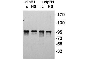 Western Blotting (WB) image for anti-ClpB2 Gene Product (CLPB2) antibody (ABIN334578) (CLPB2 anticorps)