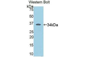 Western blot analysis of the recombinant protein. (RELB anticorps  (AA 176-436))