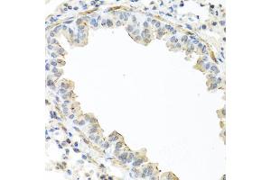 Immunohistochemistry of paraffin-embedded mouse lung using IL22 antibody (ABIN5975407) at dilution of 1/100 (40x lens). (IL-22 anticorps)