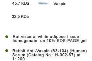 Detection of Vaspin in rat visceral fat tissue by Western Blot Kit