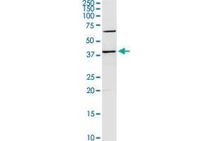 SERPINB2 MaxPab rabbit polyclonal antibody. (SERPINB2 anticorps  (AA 1-415))
